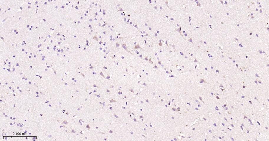 Anti-STAT3 Antibody (7U765)