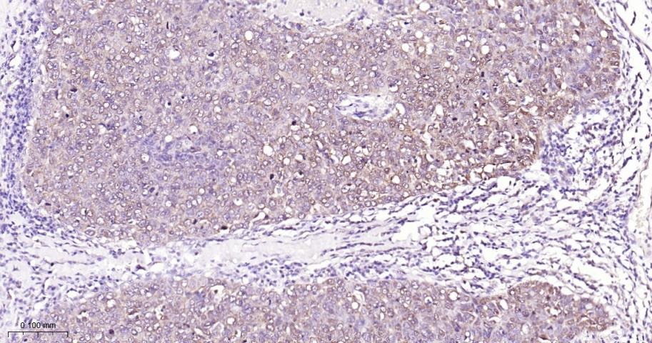 Anti-STAT3 Antibody (9V551)