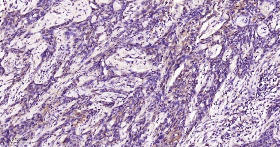 Anti-STAT3 Polyclonal Antibody 2