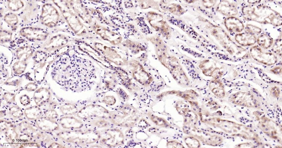Anti-STAT3 Antibody (9V551)
