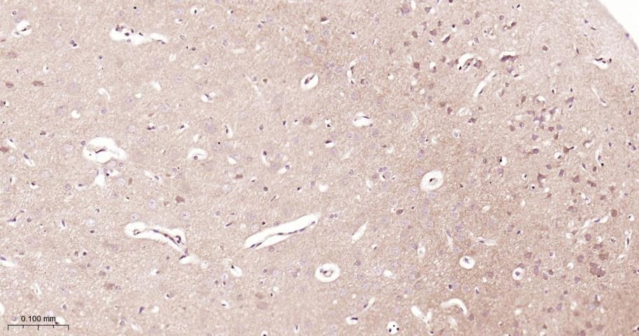 Anti-STAT3 Polyclonal Antibody 2