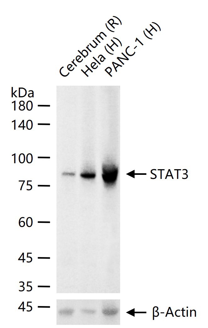 Anti-STAT3 Antibody (3R504)