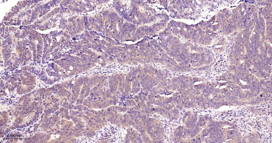Anti-STAT3 Polyclonal Antibody 2