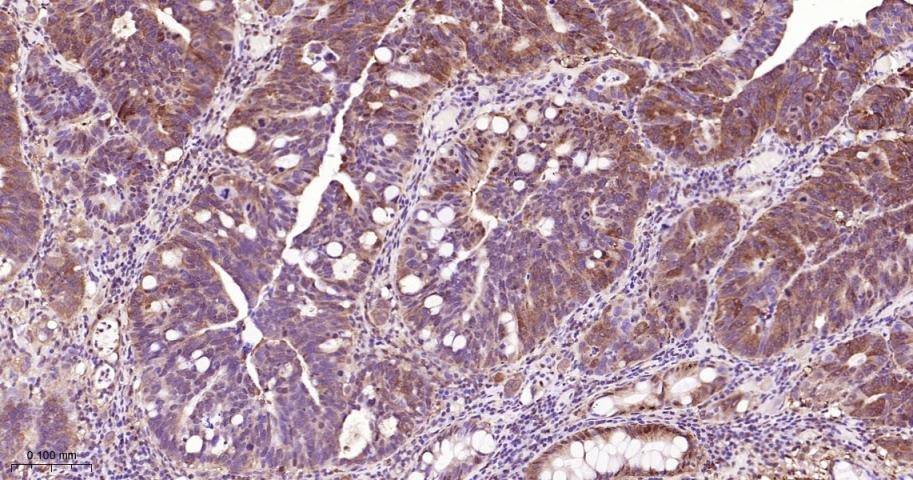 Anti-STAT3 Antibody (7U765)