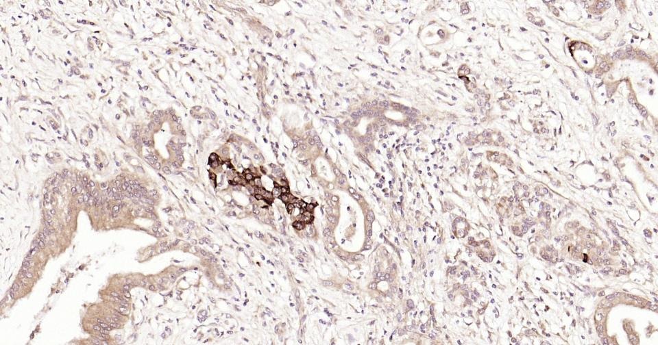 Anti-STAT3 Antibody (3R504)