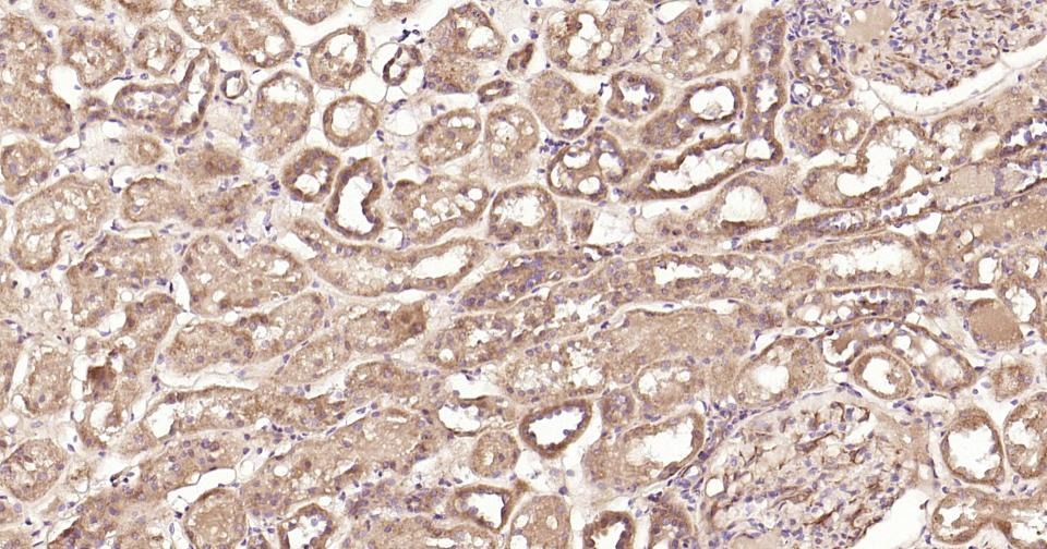 Anti-STAT3 Antibody (3R504)