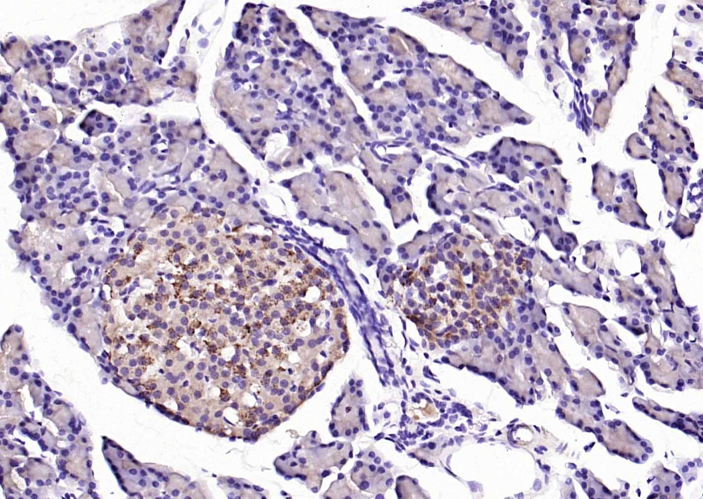 Anti-Phospho-PERK (Thr980) Polyclonal Antibody