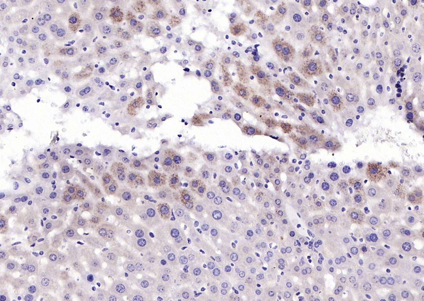 Anti-Phospho-PERK (Thr980) Polyclonal Antibody
