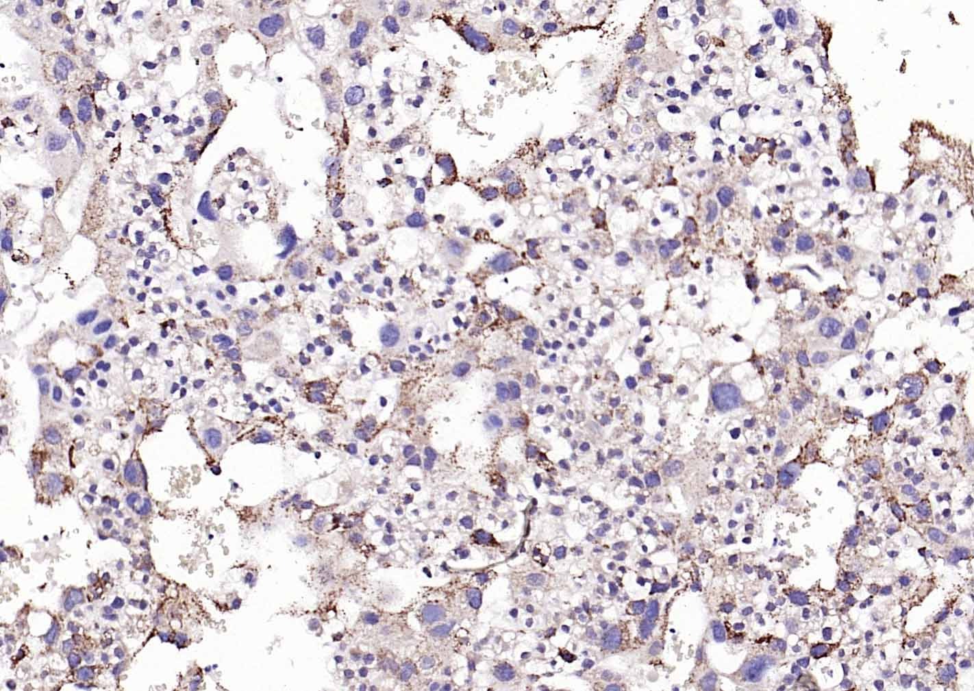 Anti-Phospho-PERK (Thr980) Polyclonal Antibody
