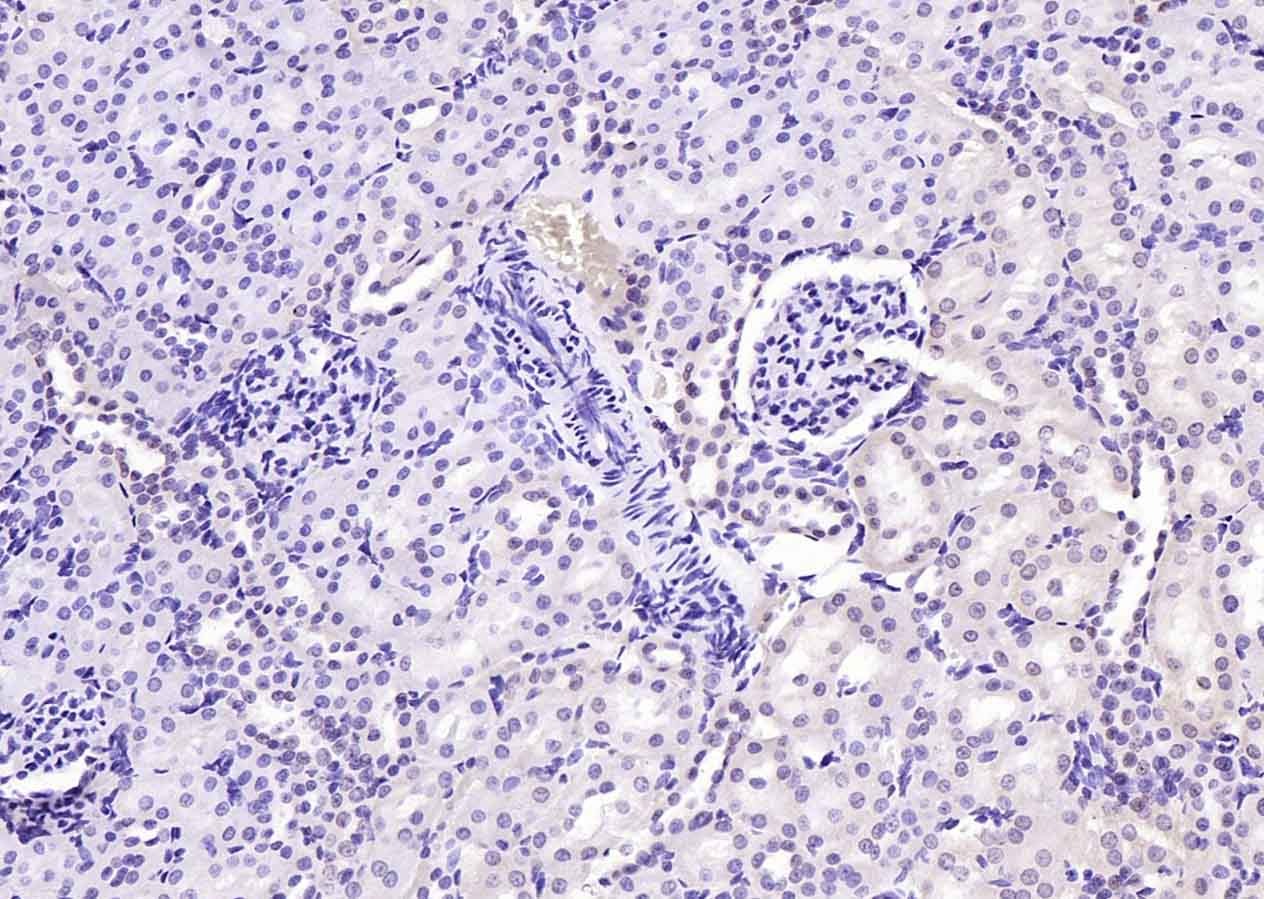 Anti-Phospho-PI3 Kinase p110 beta (Ser1070) Polyclonal Antibody