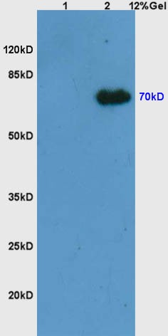 Anti-Phospho-Syk (Tyr525, 526) Polyclonal Antibody