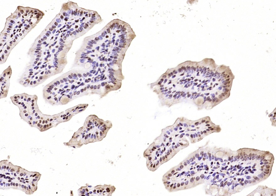 Anti-Phospho-STAT4 (Tyr693) Polyclonal Antibody