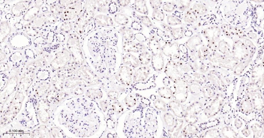 Anti-Phospho-STAT3 (Tyr705) Polyclonal Antibody 2