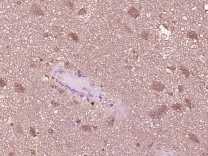Anti-Phospho-IRF3 (Ser386) Polyclonal Antibody