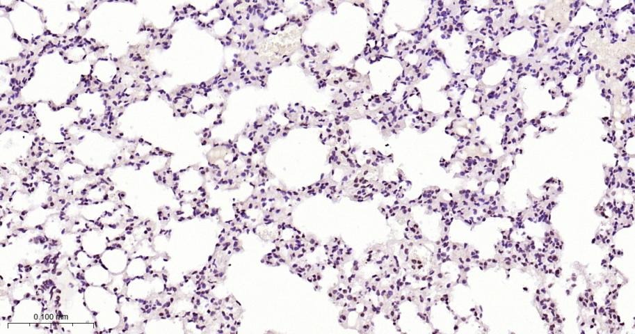 Anti-Phospho-STAT3 (Tyr705) Polyclonal Antibody 2