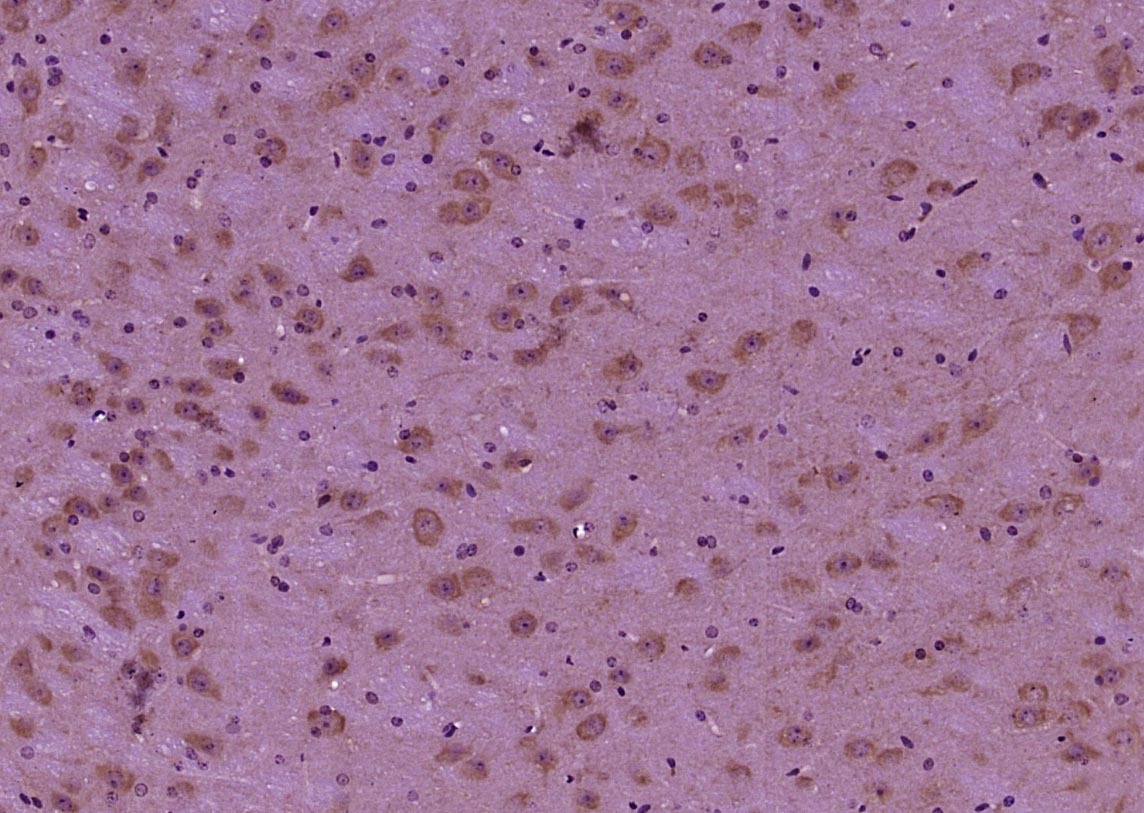Anti-Phospho-Tau (Ser396) Polyclonal Antibody