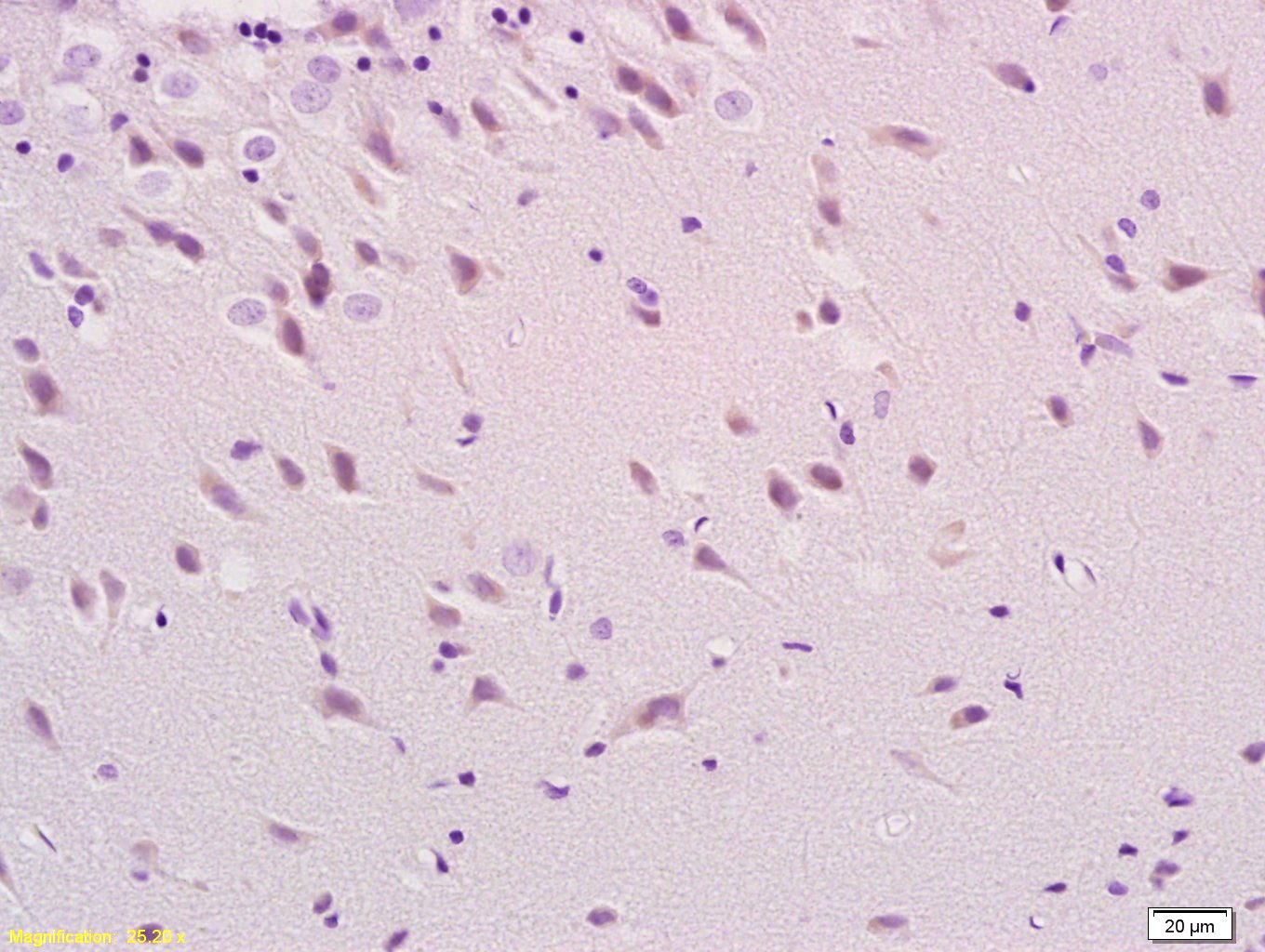 Anti-Phospho-Tau (Ser396) Polyclonal Antibody