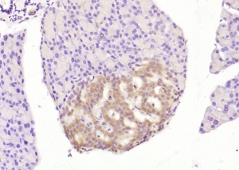Anti-Phospho-PERK (Thr980) Polyclonal Antibody 2