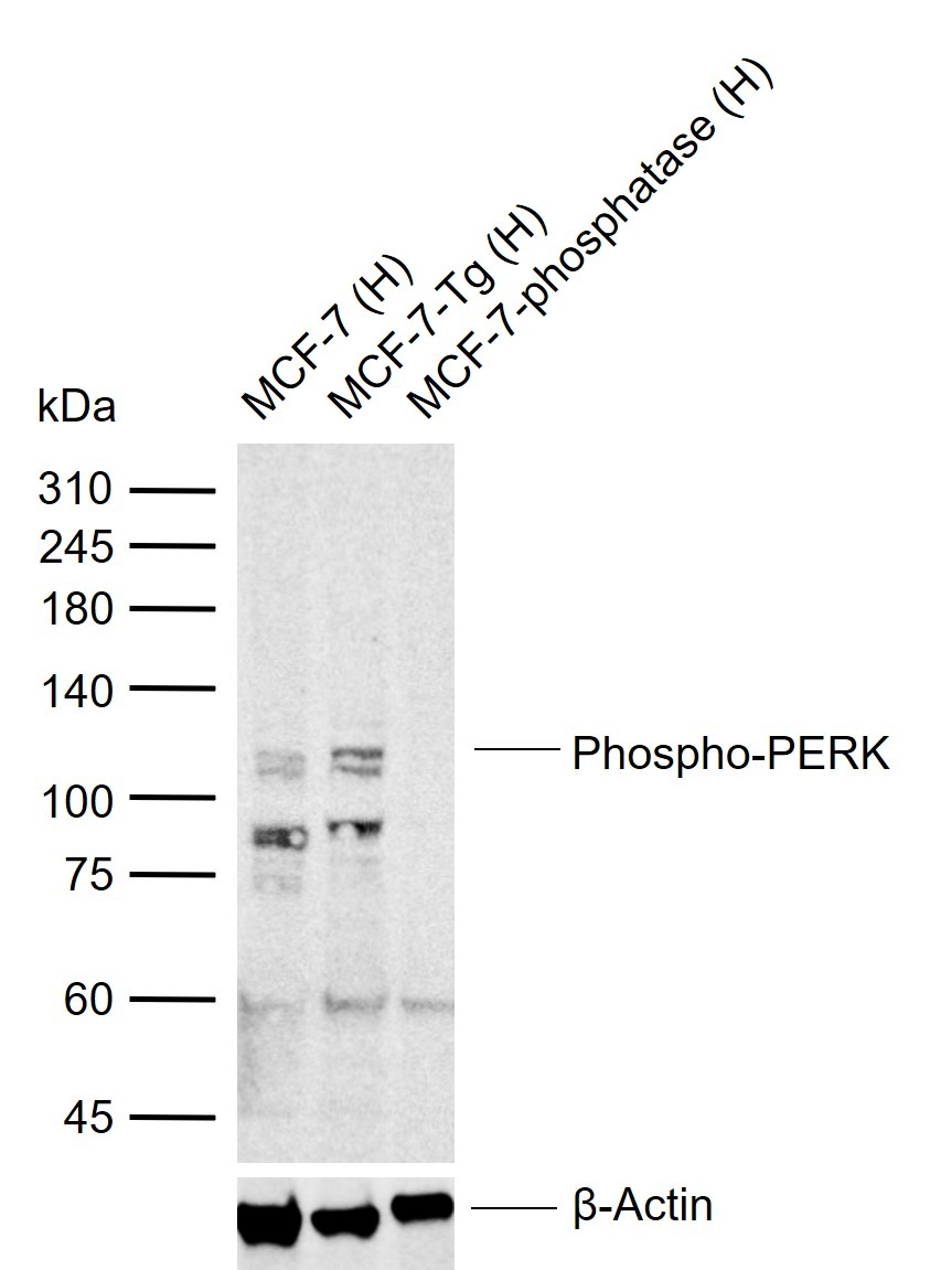 Anti-Phospho-PERK (Thr980) Polyclonal Antibody 2