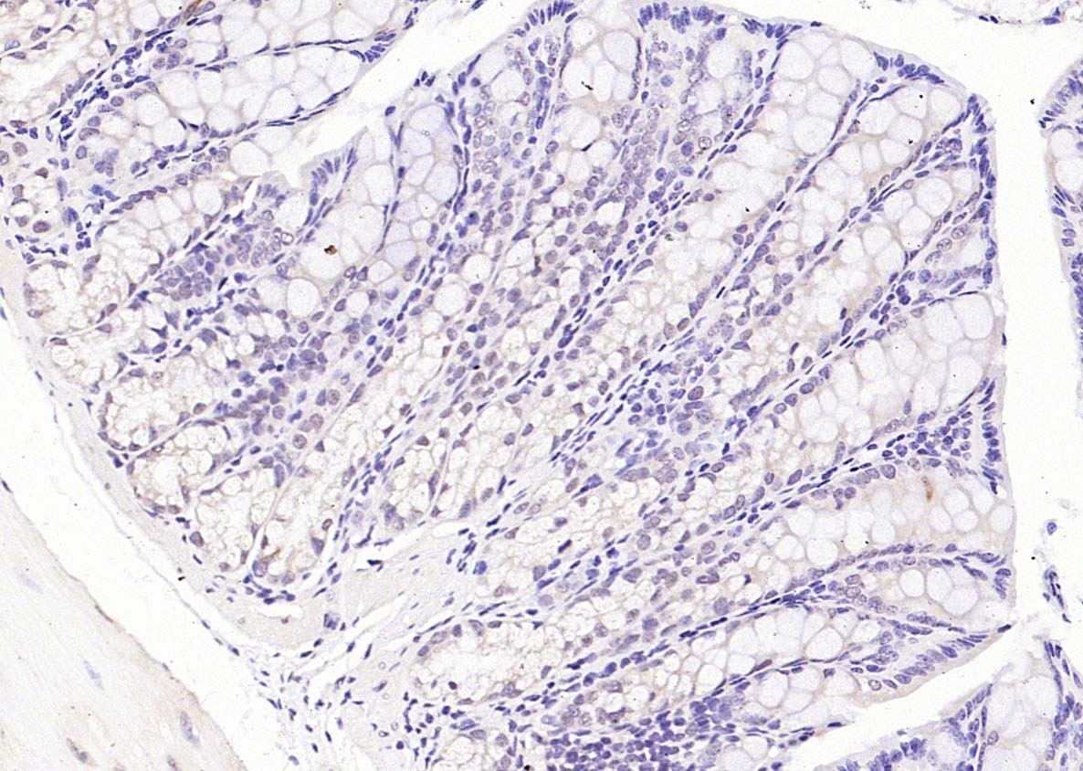 Anti-Phospho-PI3 Kinase p110 beta (Ser1070) Polyclonal Antibody