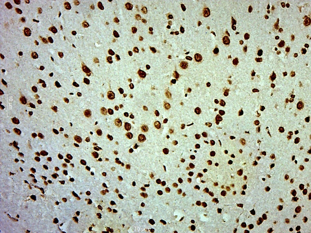 Anti-Phospho-PI3 Kinase p110 beta (Ser1070) Polyclonal Antibody