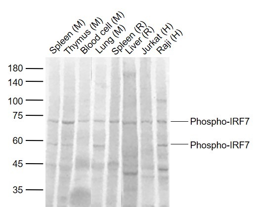Anti-Phospho-IRF7 (Ser471, 472) Polyclonal Antibody