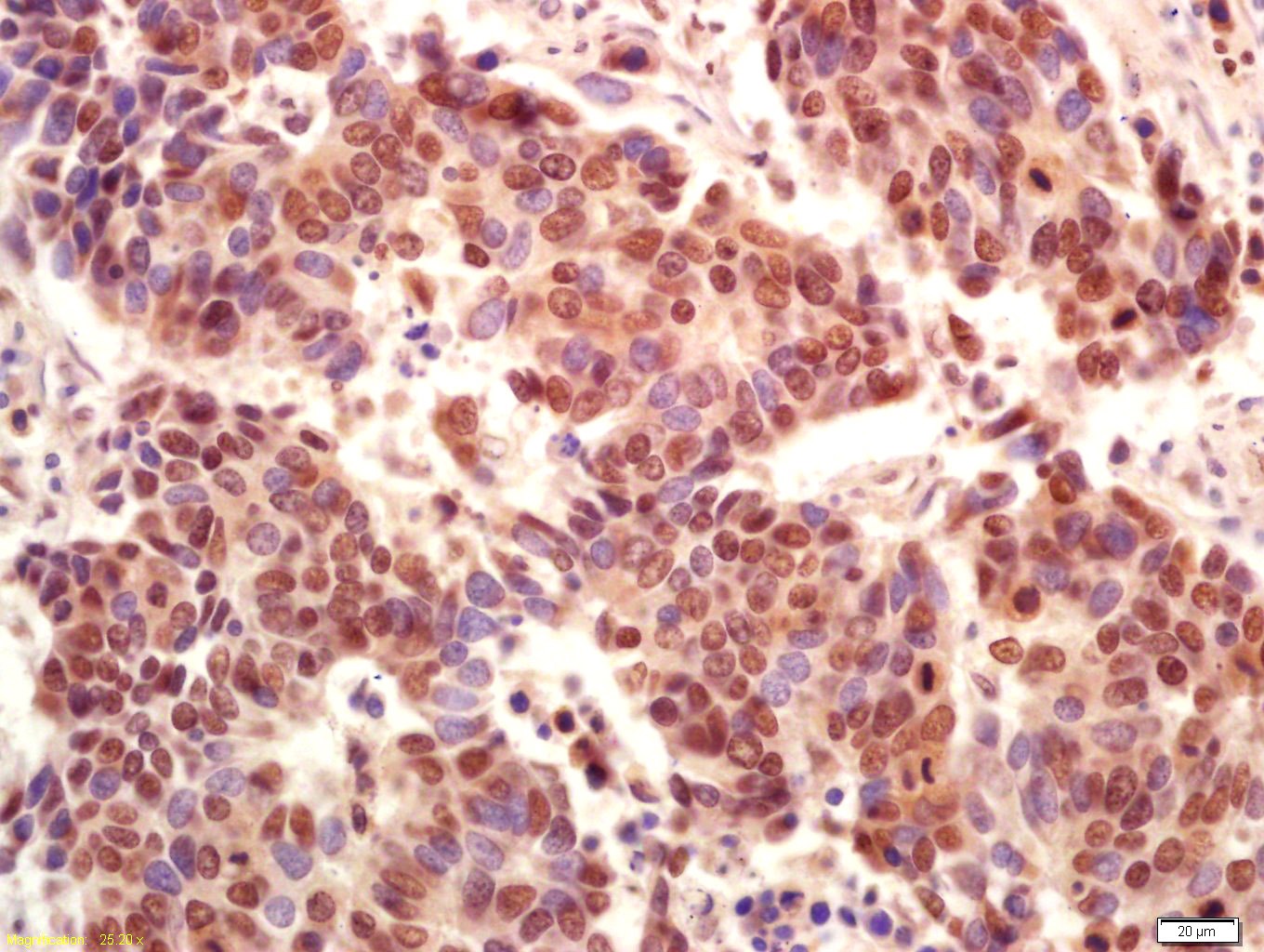 Anti-Phospho-PI3 Kinase p110 beta (Ser1070) Polyclonal Antibody