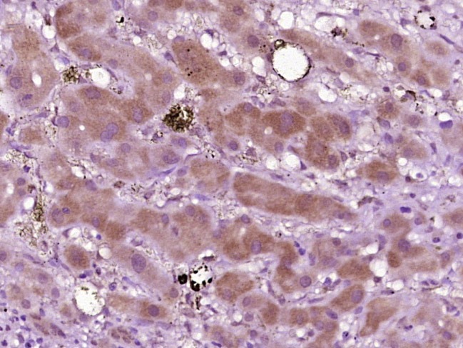 Anti-Phospho-Syk (Tyr525, 526) Polyclonal Antibody
