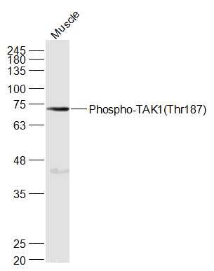 Anti-Phospho-TAK1 (Thr187) Polyclonal Antibody