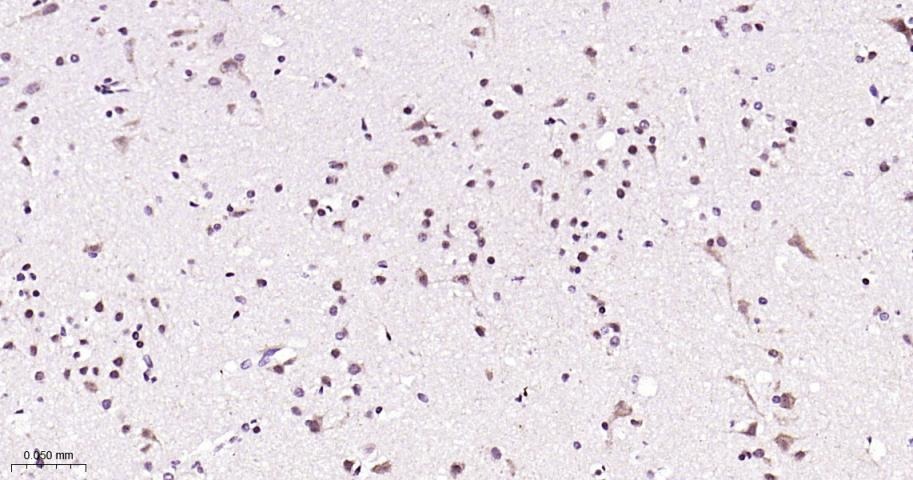 Anti-Phospho-STAT3 (Tyr705) Polyclonal Antibody 2