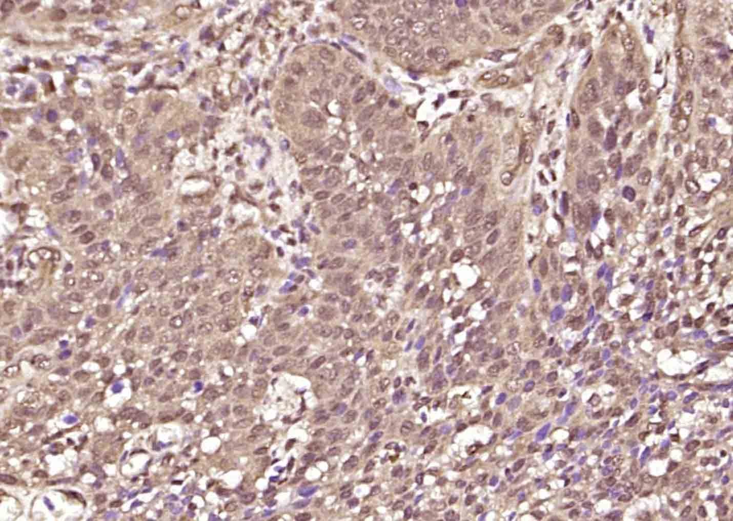 Anti-Phospho-STAT3 (Tyr705) Polyclonal Antibody 2