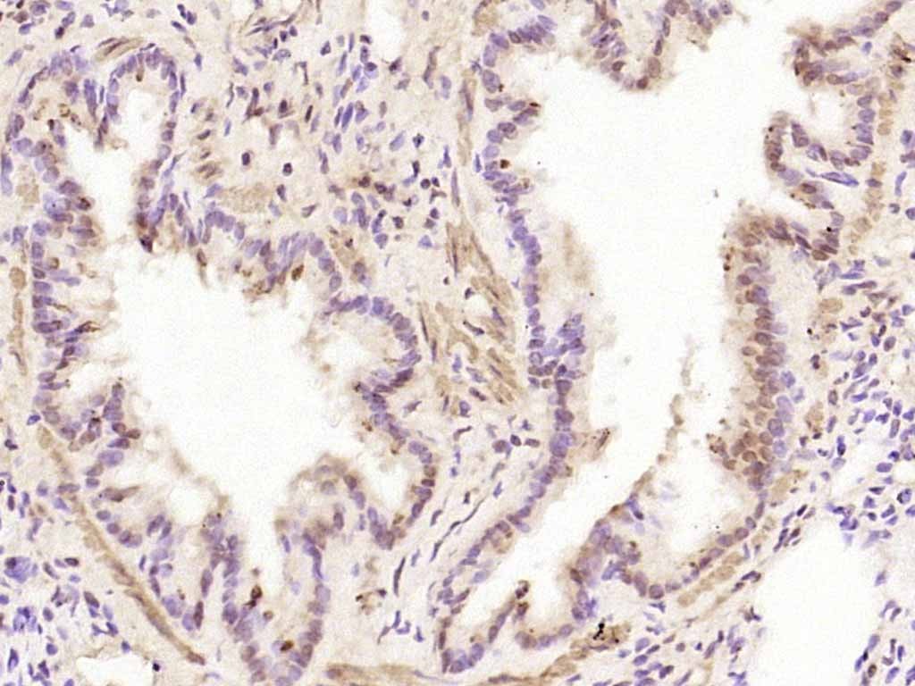 Anti-Phospho-JAK2 (Tyr1007, 1008) Polyclonal Antibody