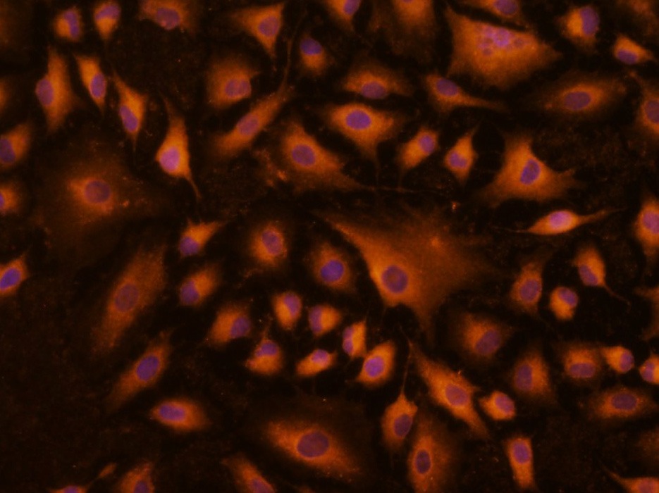 Anti-Phospho-JAK2 (Tyr1007, 1008) Polyclonal Antibody