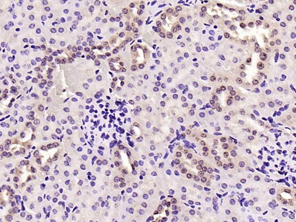 Anti-Phospho-JNK1/2/3 (Thr 183, Tyr185) Polyclonal Antibody