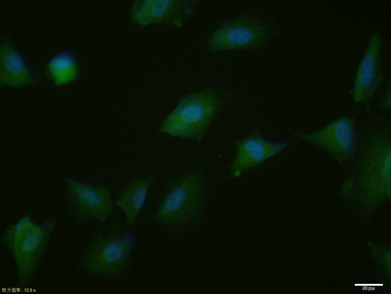 Anti-Phospho-PPAR gamma/PPARG (Ser112) Polyclonal Antibody