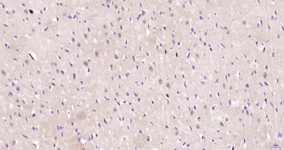 Anti-Phospho-JNK1/2/3 (Thr 183, 183, 221) Antibody (2H865)