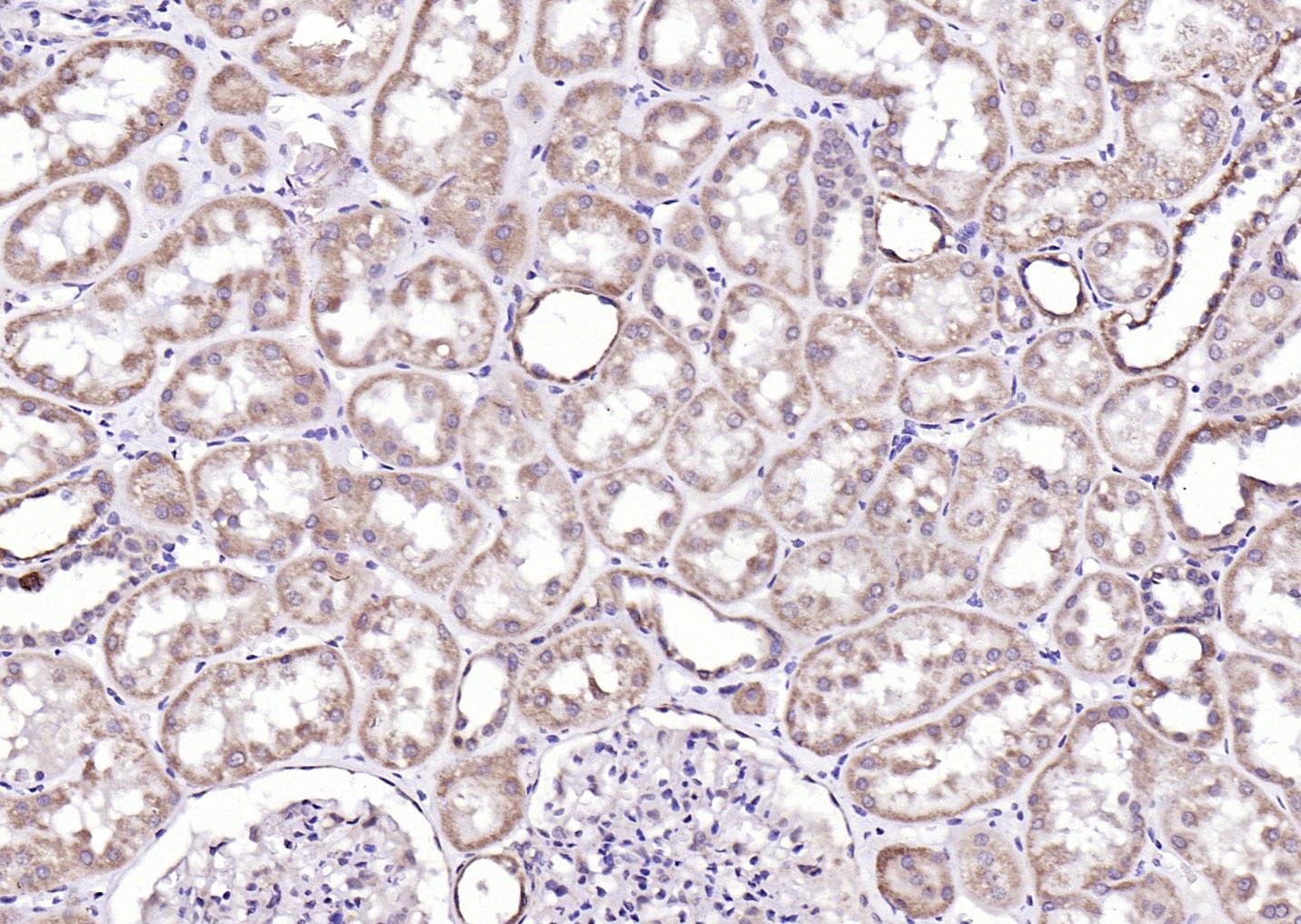 Anti-Phospho-ROCK1 (Thr455, Ser456) Polyclonal Antibody