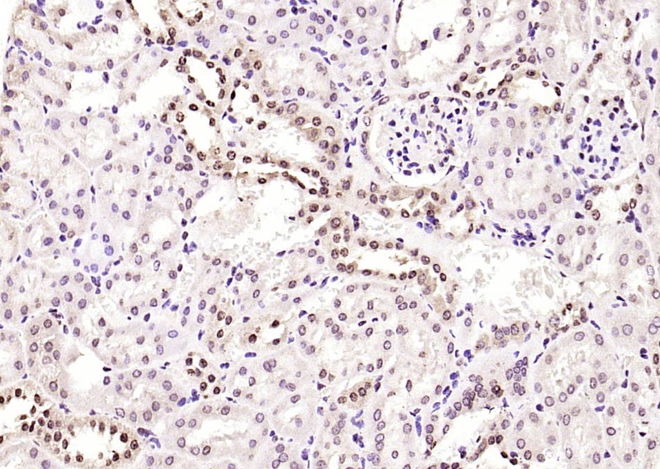 Anti-Phospho-JNK1/2/3 (Thr 183, Tyr185) Polyclonal Antibody