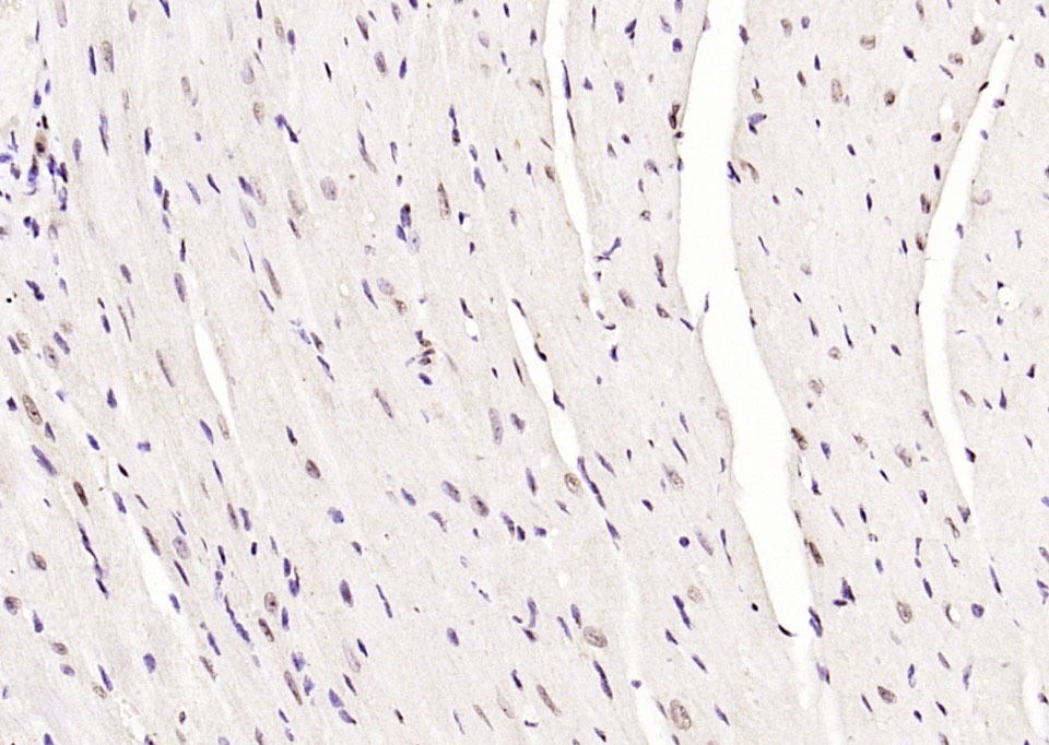 Anti-Phospho-JNK1/2/3 (Thr 183, Tyr185) Polyclonal Antibody