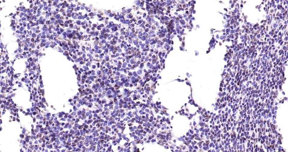 Anti-Phospho-JAK2 (Tyr1007, 1008) Antibody (2X102)