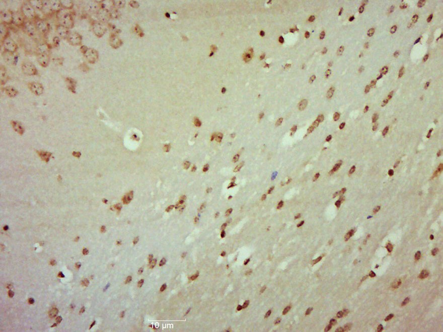 Anti-Phospho-JNK1/2/3 (Thr 183, Tyr185) Polyclonal Antibody