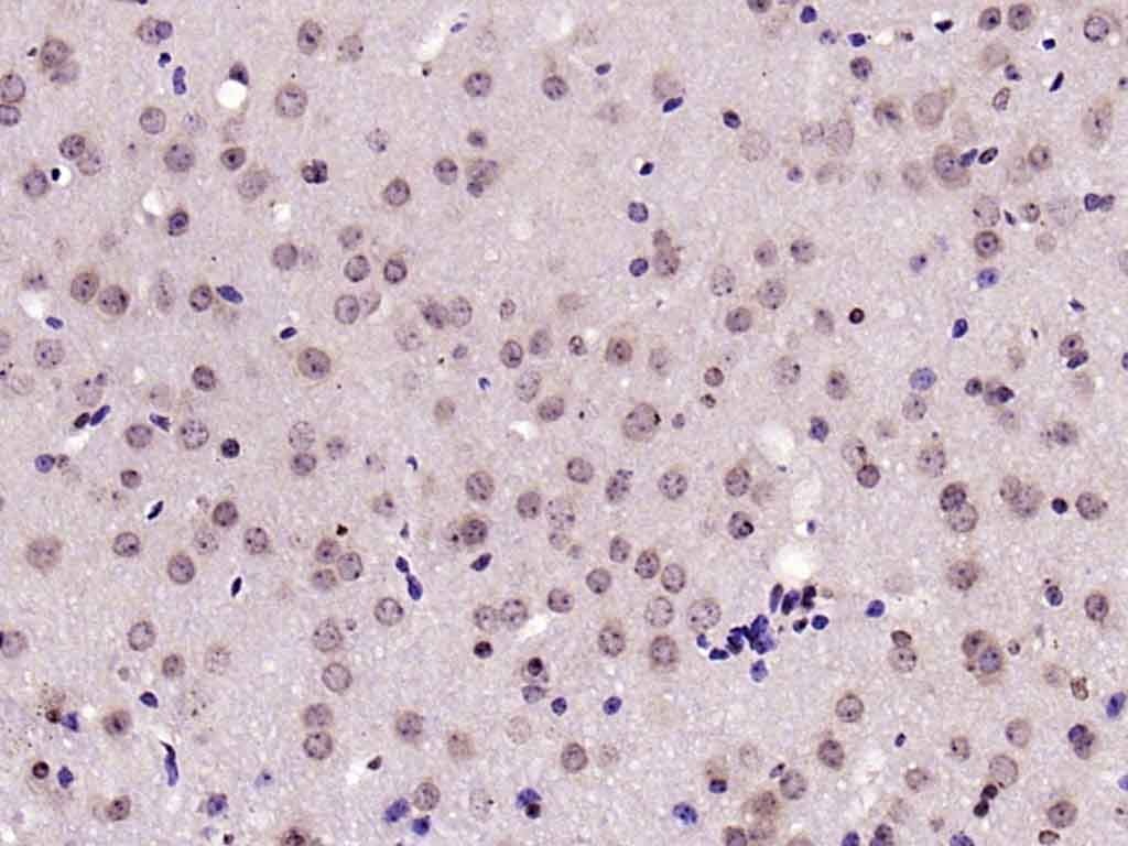 Anti-Phospho-JNK1/2/3 (Thr 183, Tyr185) Polyclonal Antibody