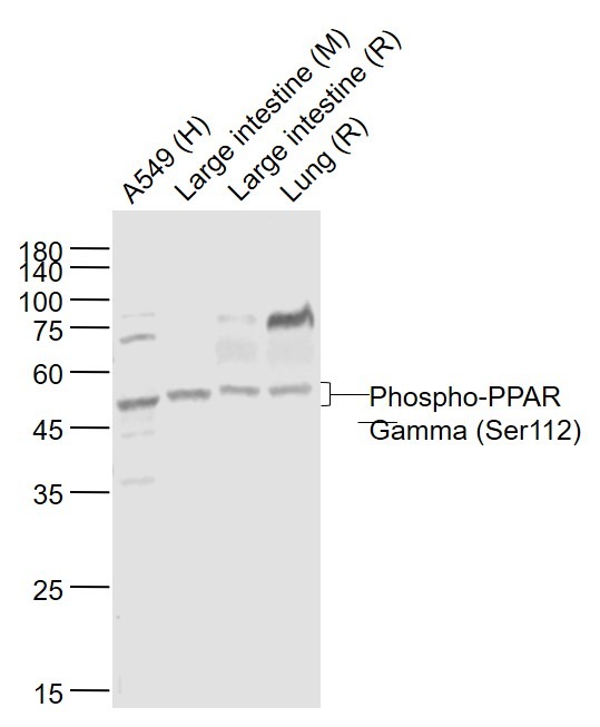 Anti-Phospho-PPAR gamma/PPARG (Ser112) Polyclonal Antibody