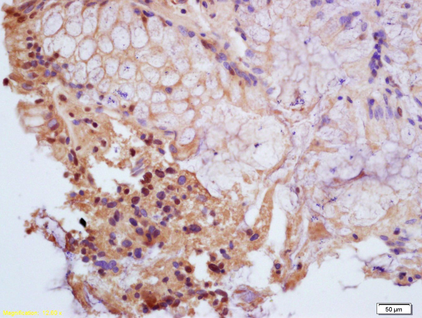 Anti-Phospho-PPAR gamma/PPARG (Ser112) Polyclonal Antibody
