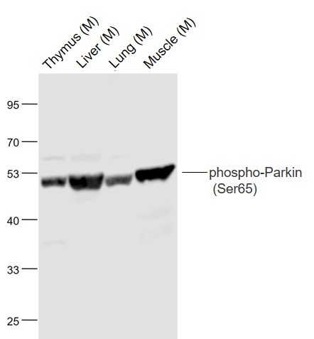 Anti-Phospho-PRKN (Ser65) Polyclonal Antibody