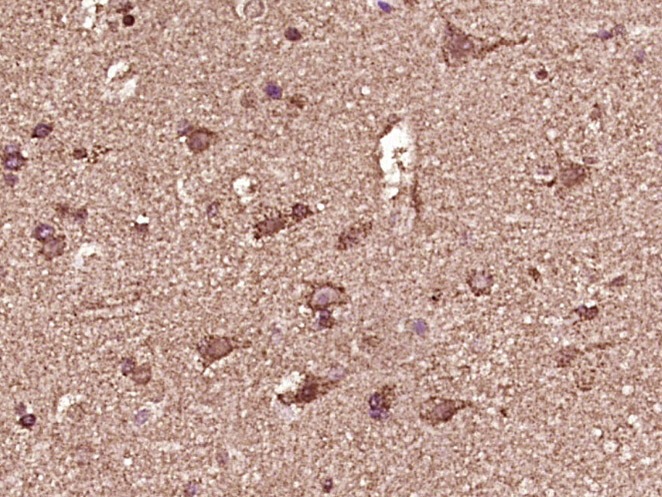 Anti-Phospho-PRKN (Ser65) Polyclonal Antibody