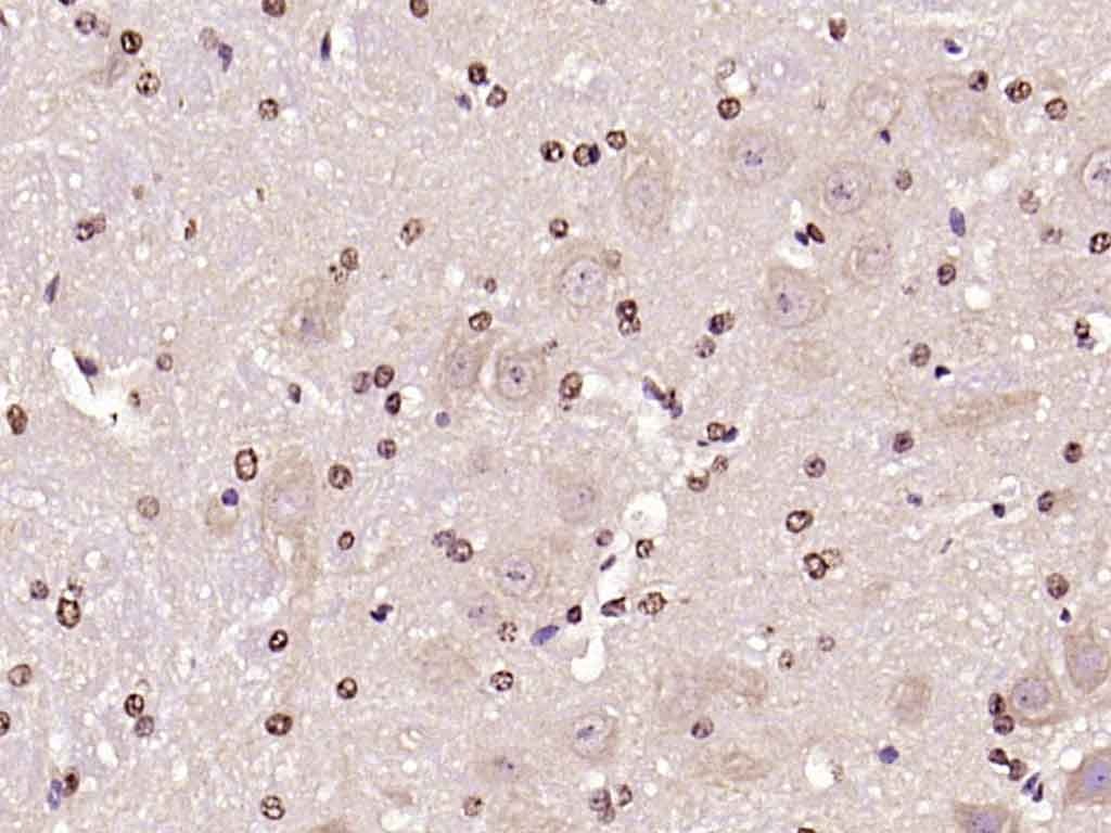 Anti-Phospho-JNK1/2/3 (Thr 183, Tyr185) Polyclonal Antibody