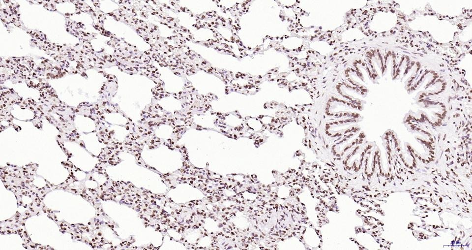 Anti-Phospho-JAK2 (Tyr1007, 1008) Antibody (2X102)