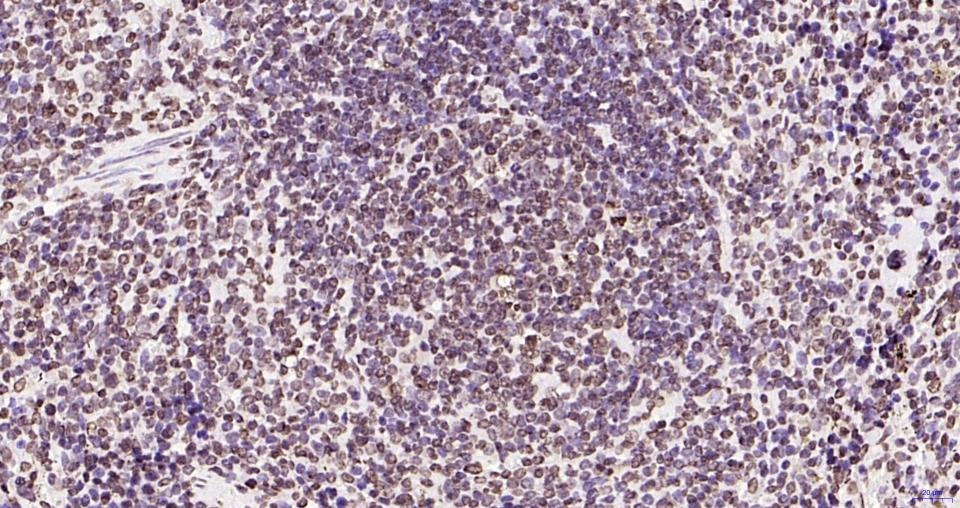 Anti-Phospho-JAK2 (Tyr1007, 1008) Antibody (2X102)