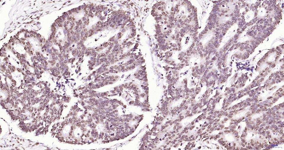 Anti-Phospho-JAK2 (Tyr1007, 1008) Antibody (2X102)